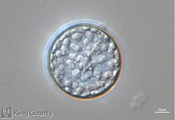 Photo of Coscinodiscus spp.